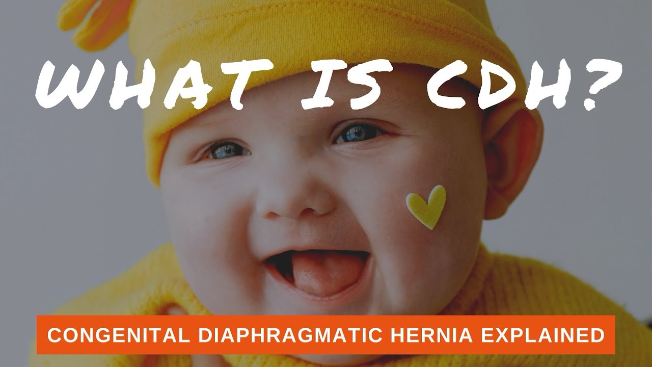 What is Congenital Diaphragmatic Hernia (CDH)?